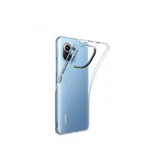 Housse de protection silicone pour Xiaomi Mi 11 Lite (Boite/BLISTER) transparent